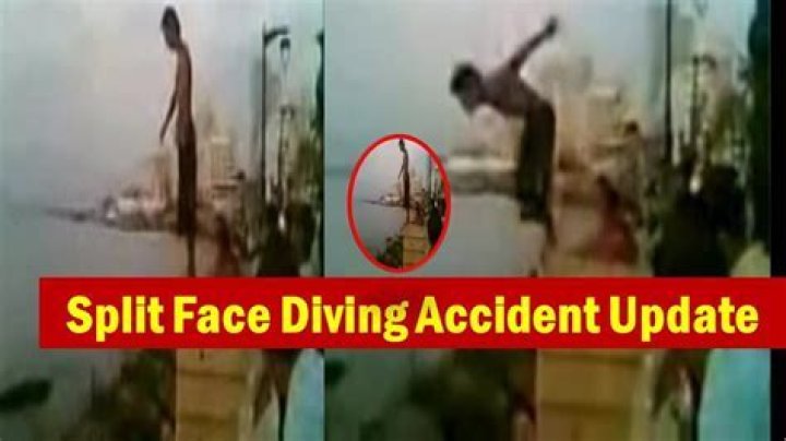 Split Face Diving Accident Video on Reddit, Twitter